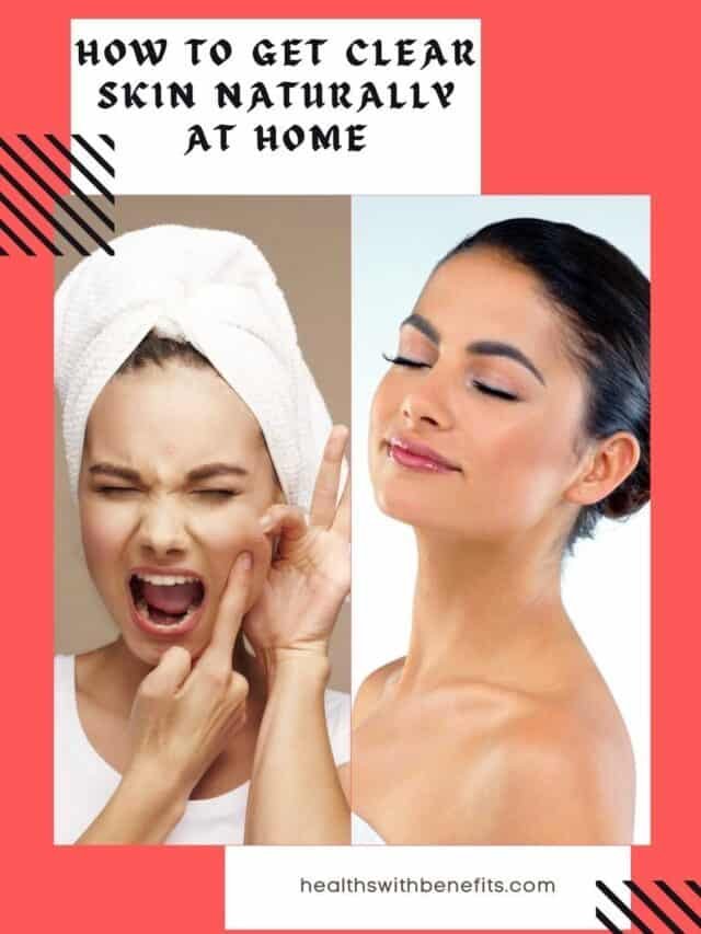 HOW TO GET CLEAR SKIN NATURALLY AT HOME